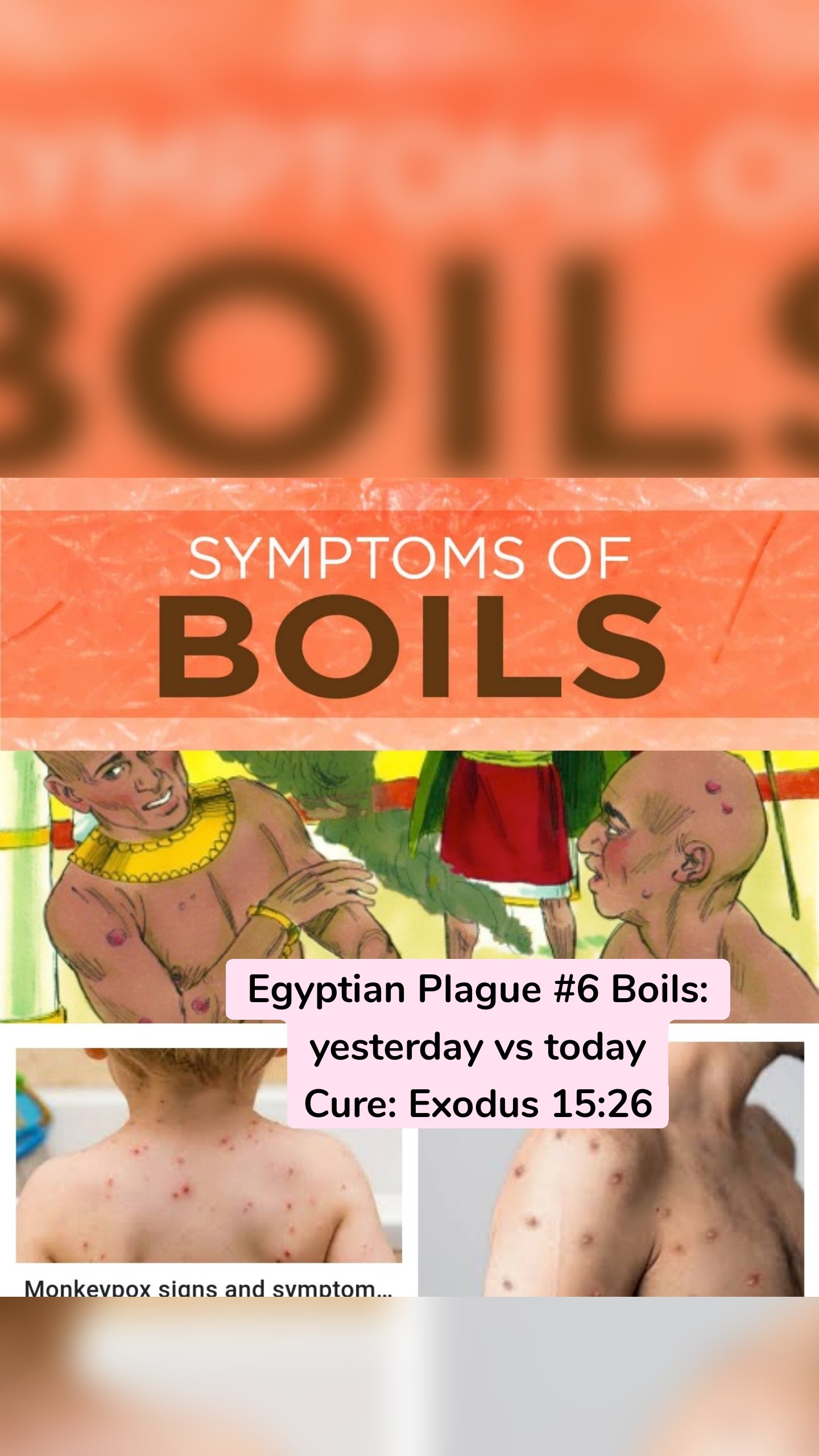 Egyptian Plague #6 Boils: yesterday vs today
Cure: Exodus 15:26